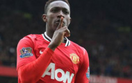 Quỷ Đỏ tiếp tục mất Welbeck trong trận đại chiến trước Arsenal