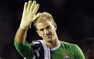 Pellegrini và FA phải… xin lỗi Joe Hart ngay lập tức!