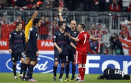 Franck Ribery: Mặc cảm chiều cao và “tai nạn” mua dâm