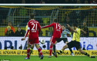 Sự dũng cảm của Pep Guardiola