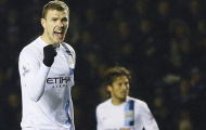 Aguero chấn thương dài hạn, cờ về tay Dzeko