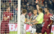 AS Roma: Thua trận đầu tiên, thua luôn đại cuộc!