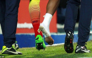 Vừa xem Barca, Neymar vừa khoe chân thương tật