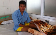Cầu thủ bị gãy chân của An Giang được ra viện