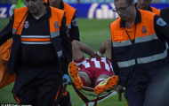 Pha chấn thương khiến Diego Costa nứt cả ống chân