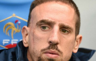 Franck Ribery chính thức không thể dự World Cup 2014