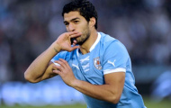 Suarez có thể ra sân dù không khỏe hoàn toàn