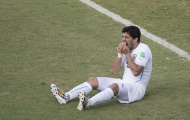 Báo chí mổ xẻ 'vết cắn đáng hổ thẹn' của Suarez