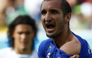 Đội trưởng Uruguay chửi Chiellini là 'kẻ hèn'