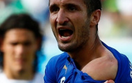 Ảnh vết răng của Suarez trên vai Chiellini là hình photoshop?