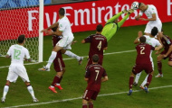 Nga thua vì thủ môn Igor Akinfeev bị chiếu đèn laser