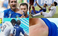 Luis Suarez mất gì sau vụ 'cẩu xực' tai tiếng