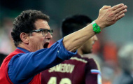 Truyền thông Nga đả kích Capello về thất bại ở World Cup