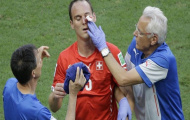 Chùm ảnh những pha chấn thương 'đẫm máu' tại World Cup 2014