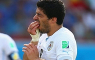 Suarez sẽ sang Kosovo đá bóng trong 4 tháng treo giò?