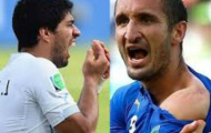 Suarez: Ngôi sao cắn người “độc nhất vô nhị” (Kỳ 3)