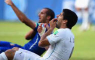 Suarez: Ngôi sao cắn người “độc nhất vô nhị” (Kỳ 4)