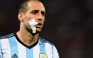 Tuyển thủ Argentina tí tởn khoe hình sứt môi trên mạng