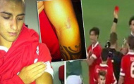 'Luiz Suarez 2.0' xuất hiện trong trận đấu tại Coppa Italia
