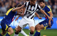 Juventus khốn đốn vì cúm