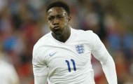 Manchester United sẽ phải hối hận vì để Welbeck ra đi