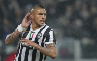 Tình hình của Arturo Vidal khiến Quỷ đỏ phải xem xét lại