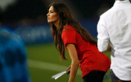Bạn gái Casillas khoe sẹo để bảo vệ đồng nghiệp