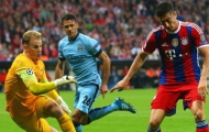 Joe Hart sẽ trở lại trận gặp AS Roma