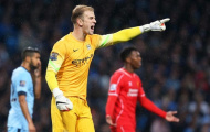 Liverpool đặt Joe Hart trong tầm nhắm