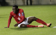 Arsenal 'hú vía' với chấn thương của Danny Welbeck