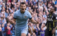 Lịch sử gọi tên Aguero