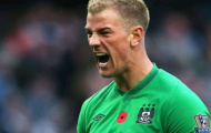 Hart: Man City đá quá tệ