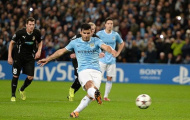 Sergio Aguero bị nghi ngờ chấn thương