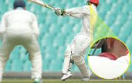 SAO môn cricket qua đời vì bị ném bóng trúng đầu