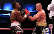Hạ Dereck Chisora, Tyson Fury thách thức Wladimir Klitschko
