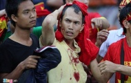 Malaysia có thể bị phạt nặng vì CĐV đánh fan Việt Nam