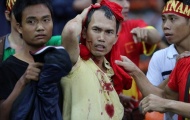VFF yêu cầu Malaysia đưa kẻ hành hung CĐV Việt Nam ra pháp luật
