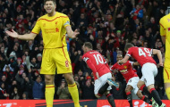 Derby của những sai lầm