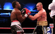 Tyson Fury muốn thâu tóm mọi đai vô địch