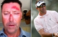 Golf thủ Australia bị bắt cóc, đánh đập và quẳng vào công viên