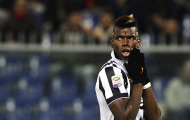 Ancelotti đã nói dối về vụ Pogba