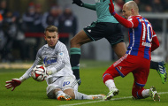 Những cú vấp cần thiết cho Bayern Munich