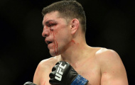Ngay cả HLV cũng chẳng tin Nick Diaz
