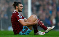 ÁC MỘNG của Andy Carroll: Lại nghỉ hết mùa vì đầu gối!