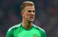 Joe Hart – Trò đùa của tạo hóa