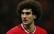 Sao Man United bị đánh hộc máu mũi