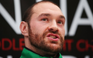 Tyson Fury tự tin hạ knock-out Christian Hammer