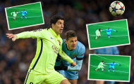 Suarez phủ nhận chuyện tái phát 'bệnh cũ'