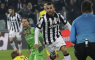 Juventevez – Vì cả 2 cần đến nhau!