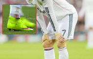 Cristiano Ronaldo đổ máu trong trận cầu thất vọng